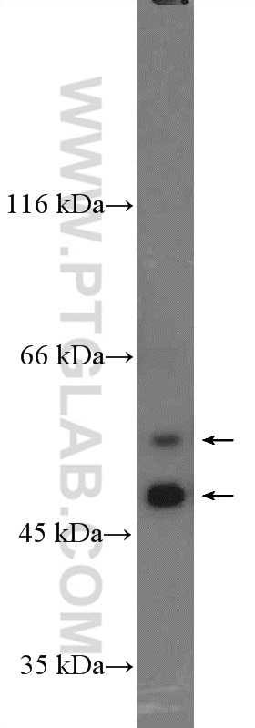 Western Blot (WB) analysis of COLO 320 cells using FAM155A Polyclonal antibody (24929-1-AP)