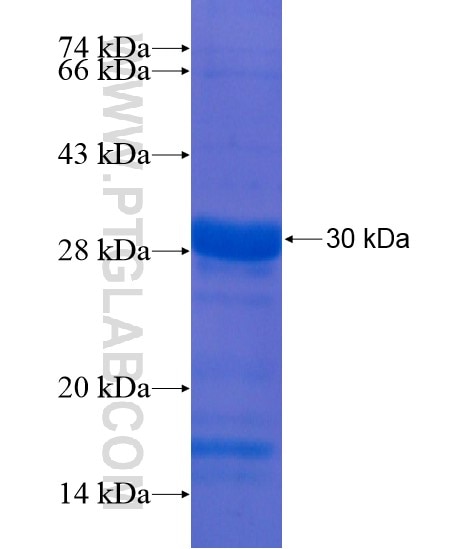 FAM155A fusion protein Ag21575 SDS-PAGE