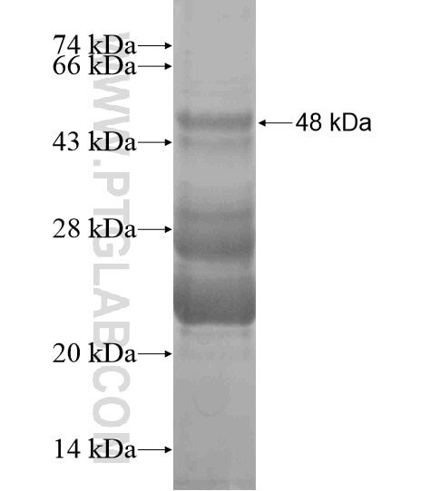 FAM155B fusion protein Ag20423 SDS-PAGE