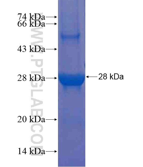 FAM155B fusion protein Ag20442 SDS-PAGE