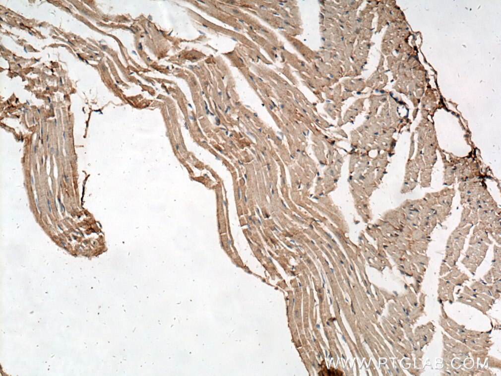 Immunohistochemistry (IHC) staining of mouse heart tissue using FAM156A Polyclonal antibody (16914-1-AP)