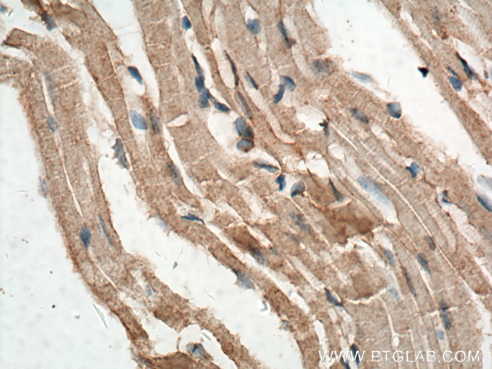 Immunohistochemistry (IHC) staining of mouse heart tissue using FAM156A Polyclonal antibody (16914-1-AP)