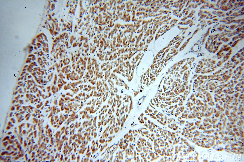 Immunohistochemistry (IHC) staining of human heart tissue using FAM156A Polyclonal antibody (16914-1-AP)