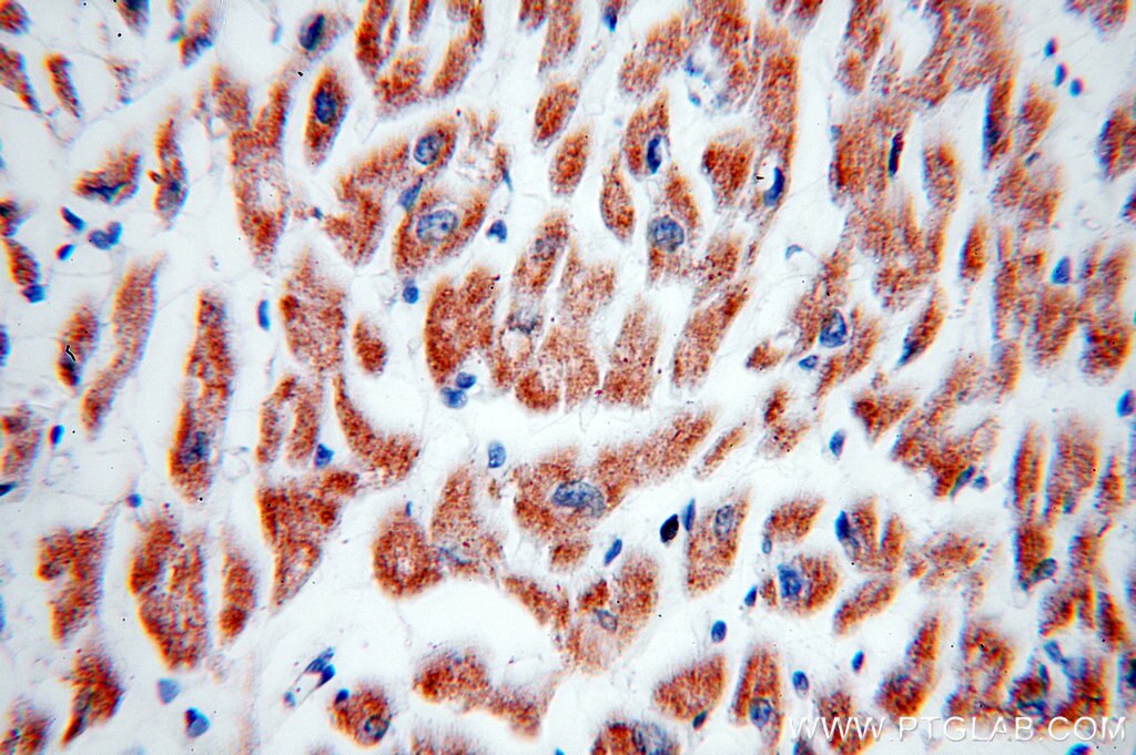 Immunohistochemistry (IHC) staining of human heart tissue using FAM156A Polyclonal antibody (16914-1-AP)