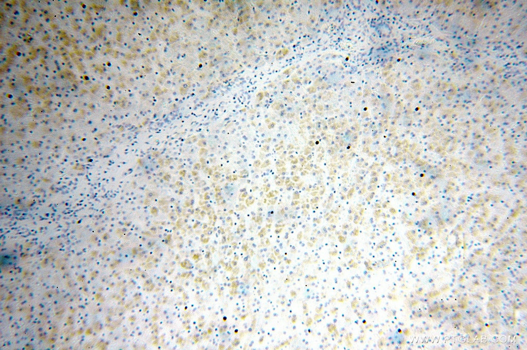 Immunohistochemistry (IHC) staining of human liver tissue using FAM156A Polyclonal antibody (16914-1-AP)