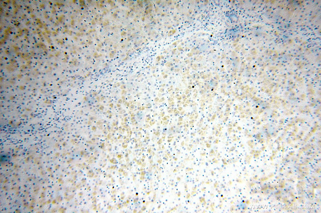 Immunohistochemistry (IHC) staining of human liver tissue using FAM156A Polyclonal antibody (16914-1-AP)