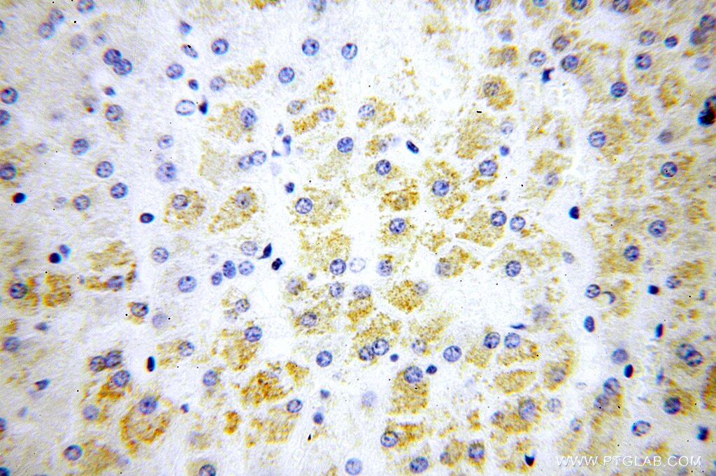 Immunohistochemistry (IHC) staining of human liver tissue using FAM156A Polyclonal antibody (16914-1-AP)