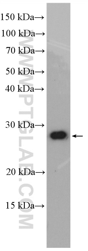 Western Blot (WB) analysis of PC-13 cells using FAM156A Polyclonal antibody (16914-1-AP)