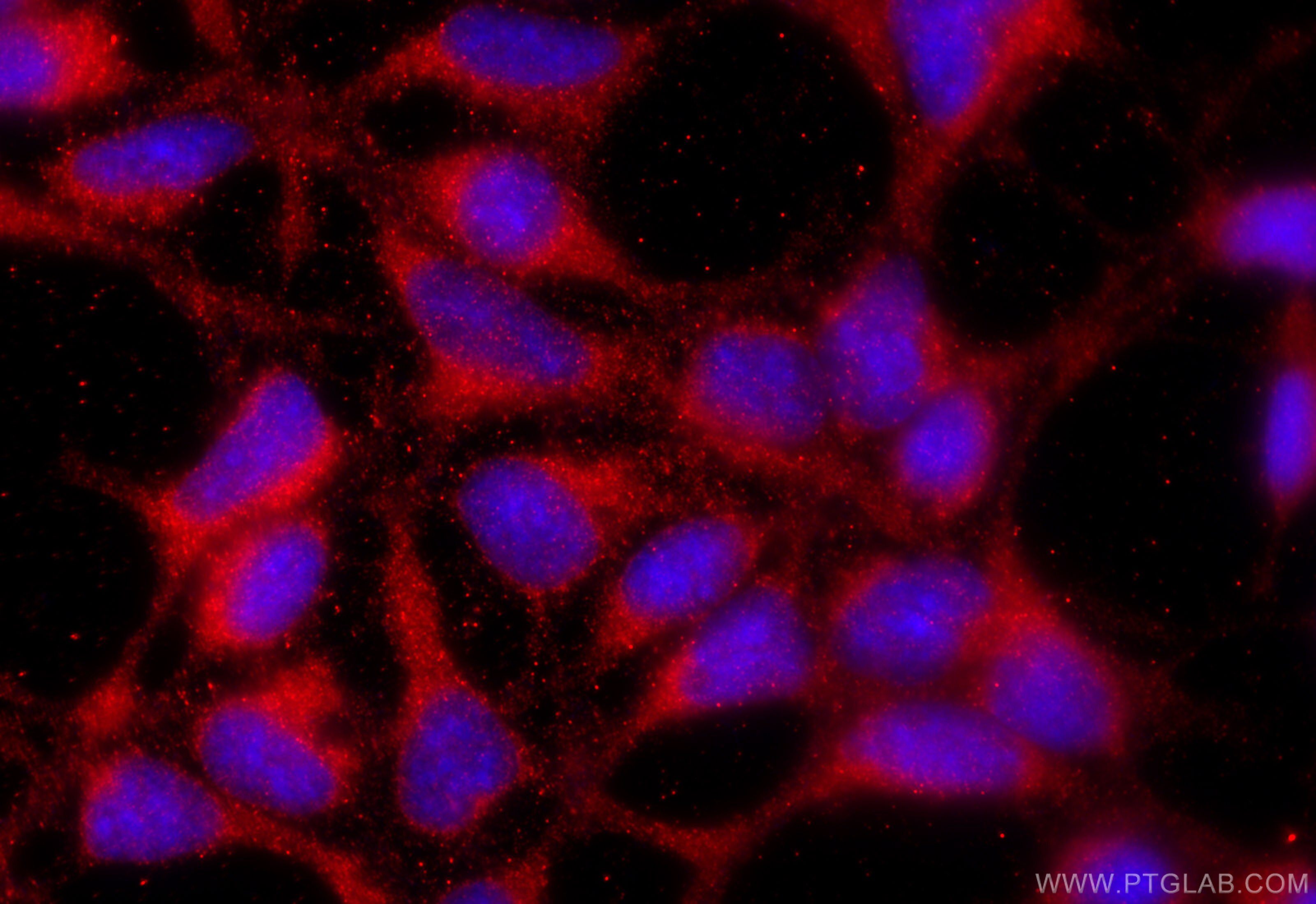 Immunofluorescence (IF) / fluorescent staining of HEK-293 cells using FAM158A Polyclonal antibody (23919-1-AP)