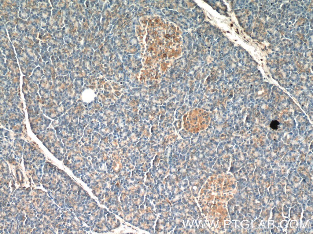 Immunohistochemistry (IHC) staining of human pancreas tissue using FAM158A Polyclonal antibody (23919-1-AP)