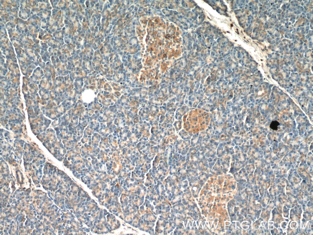 IHC staining of human pancreas using 23919-1-AP