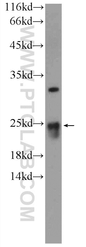 Western Blot (WB) analysis of HEK-293 cells using FAM158A Polyclonal antibody (23919-1-AP)