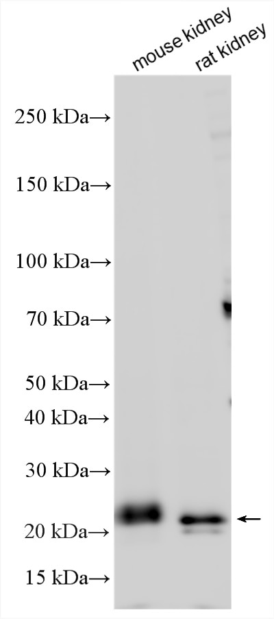 Western Blot (WB) analysis of various lysates using FAM158A Polyclonal antibody (23919-1-AP)