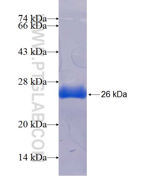 FAM158A fusion protein Ag20744 SDS-PAGE