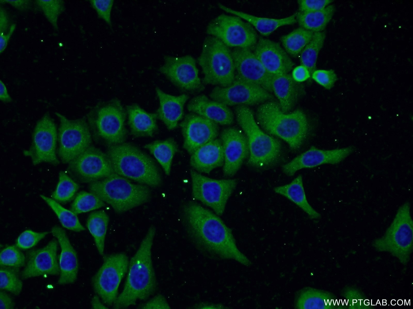 Immunofluorescence (IF) / fluorescent staining of PC-3 cells using FAM160B1 Polyclonal antibody (25388-1-AP)