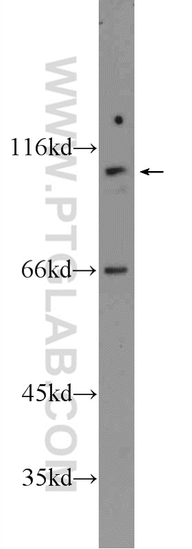 Western Blot (WB) analysis of PC-3 cells using FAM160B1 Polyclonal antibody (25388-1-AP)