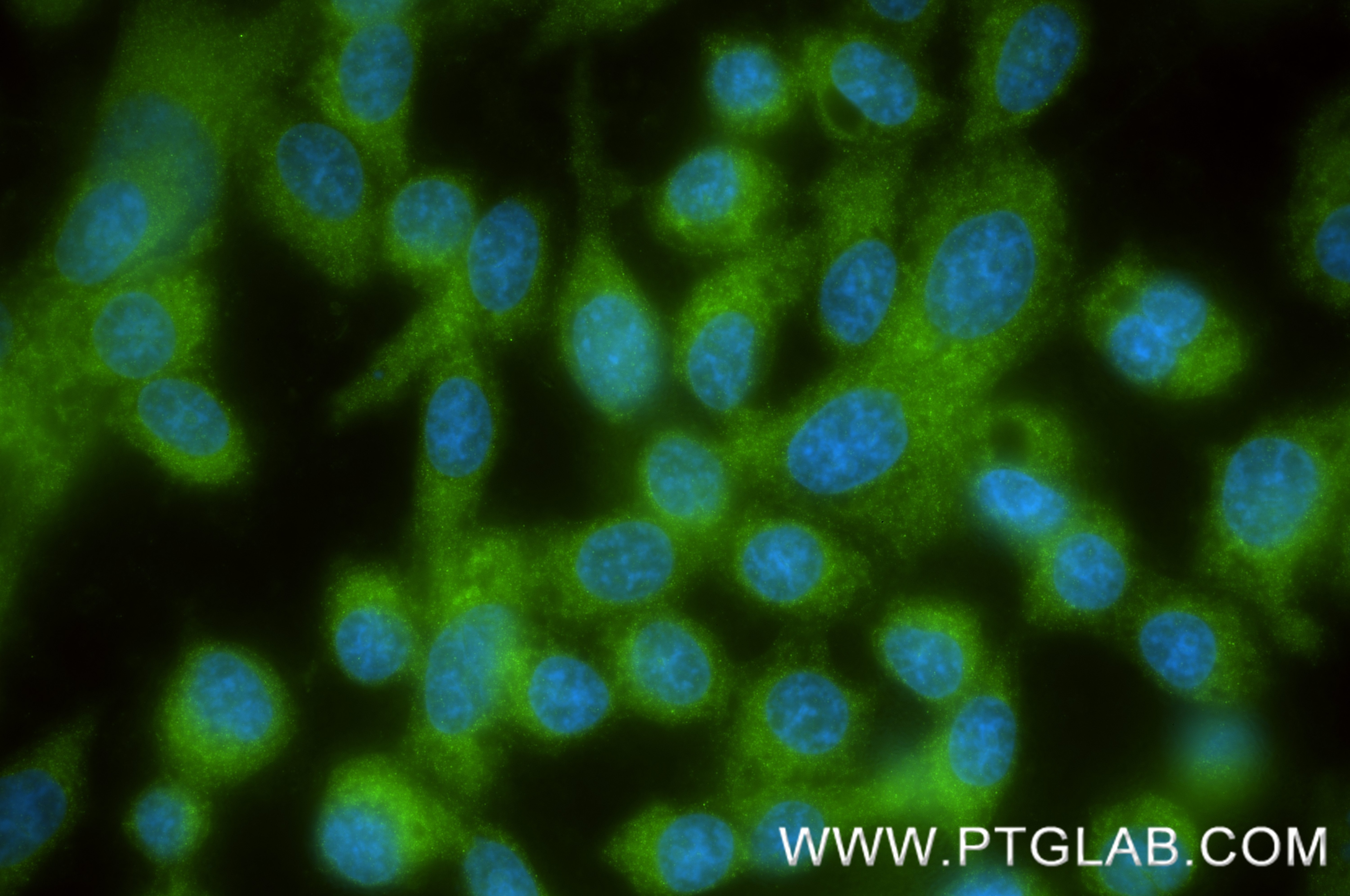 IF Staining of PC-3 using 86980-1-RR (same clone as 86980-1-PBS) Immunofluorescence (IF) / fluorescent staining of PC-3 cells using FAM160B1 Recombinant monoclonal antibody (86980-1-RR)