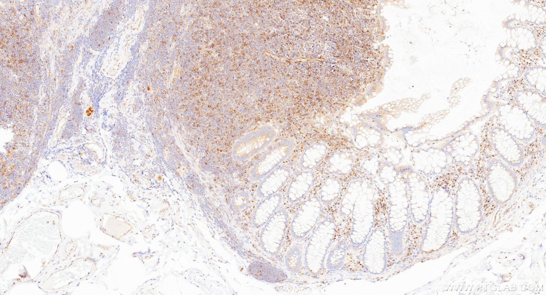 Immunohistochemistry (IHC) staining of human colon tissue using FAM160B1 Recombinant monoclonal antibody (86980-1-RR)