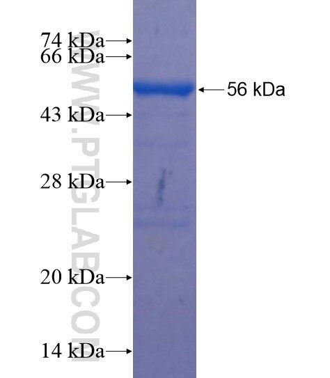 FAM160B1 fusion protein Ag22051 SDS-PAGE