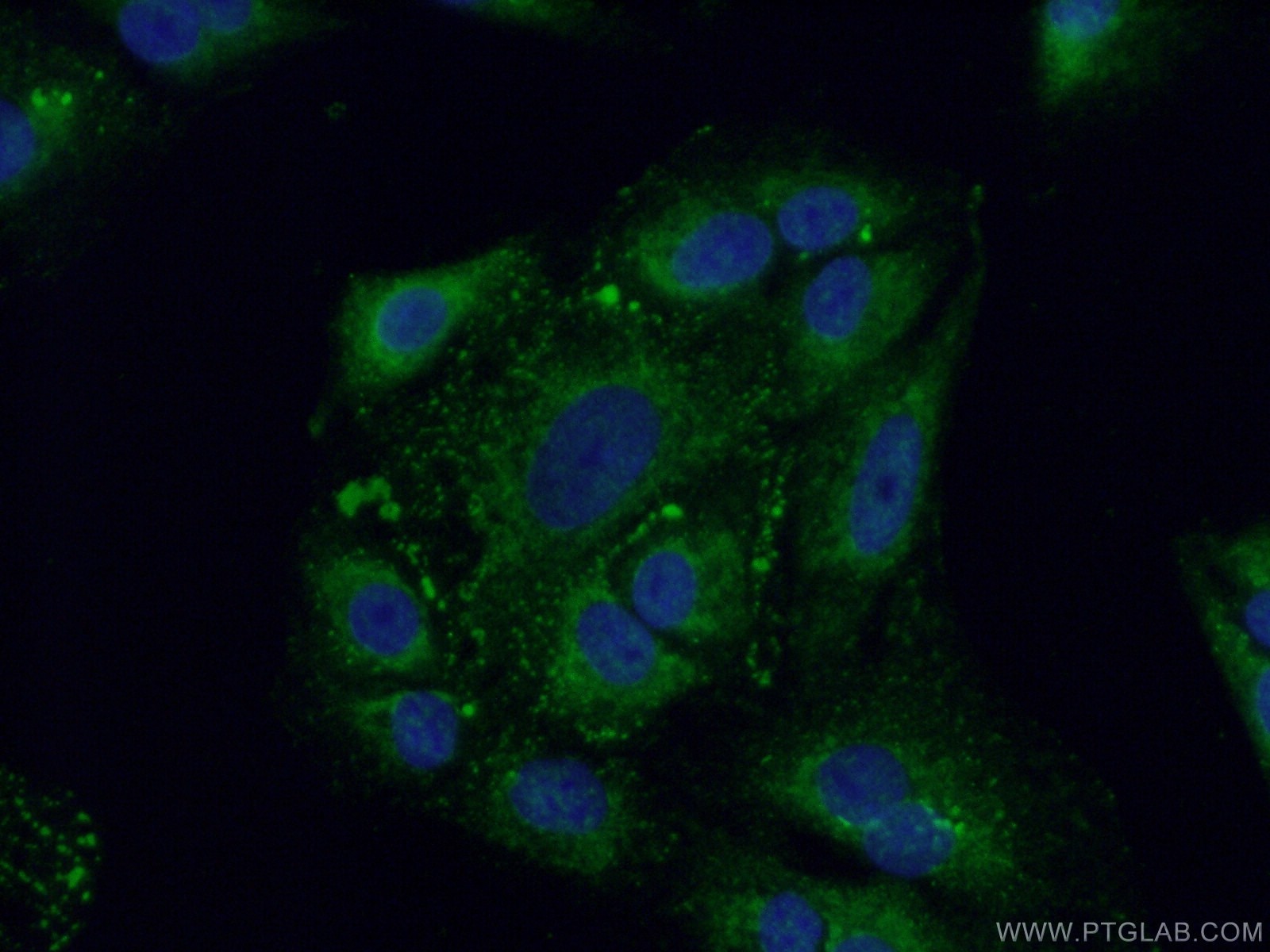 Immunofluorescence (IF) / fluorescent staining of A549 cells using FAM160B2 Polyclonal antibody (17147-1-AP)