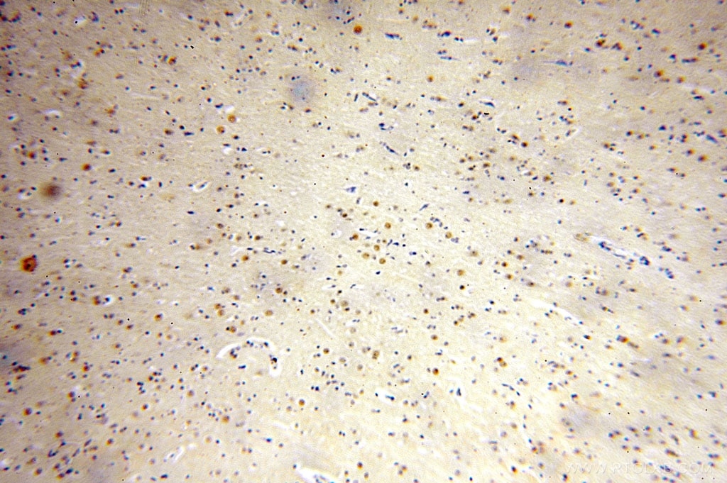 Immunohistochemistry (IHC) staining of human brain tissue using FAM160B2 Polyclonal antibody (17147-1-AP)