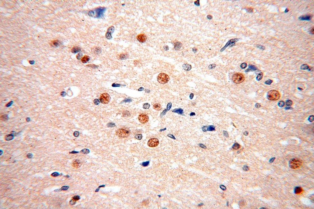 Immunohistochemistry (IHC) staining of human brain tissue using FAM160B2 Polyclonal antibody (17147-1-AP)