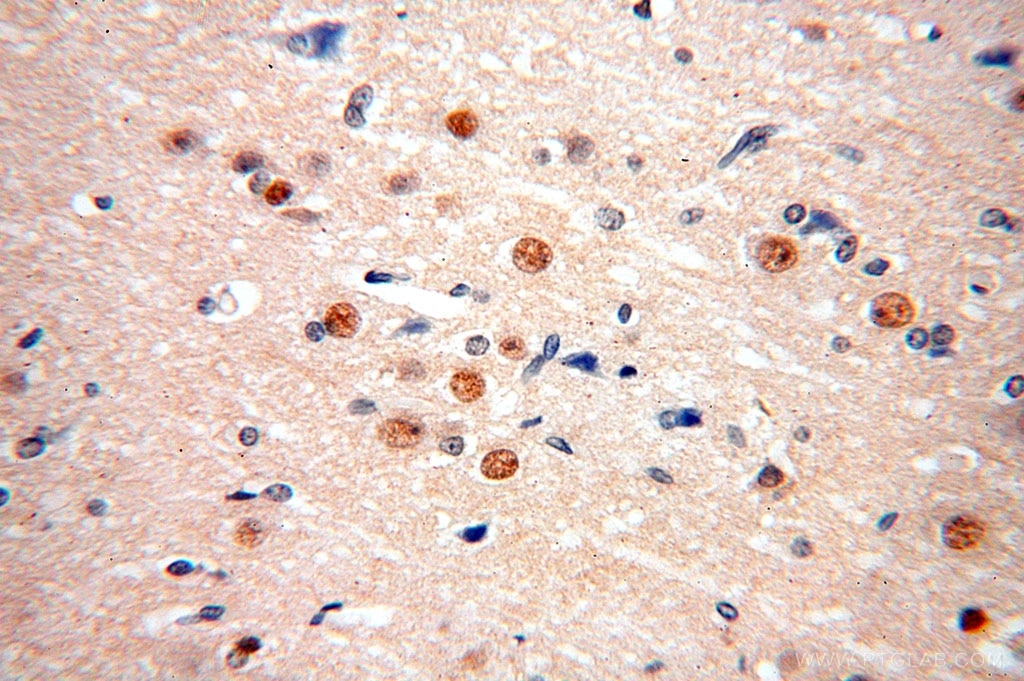 IHC staining of human brain using 17147-1-AP