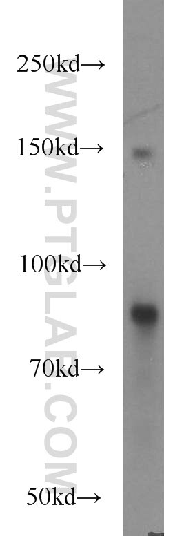 Western Blot (WB) analysis of human brain tissue using FAM160B2 Polyclonal antibody (17147-1-AP)