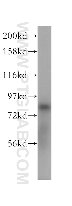 Western Blot (WB) analysis of human brain tissue using FAM160B2 Polyclonal antibody (17147-1-AP)