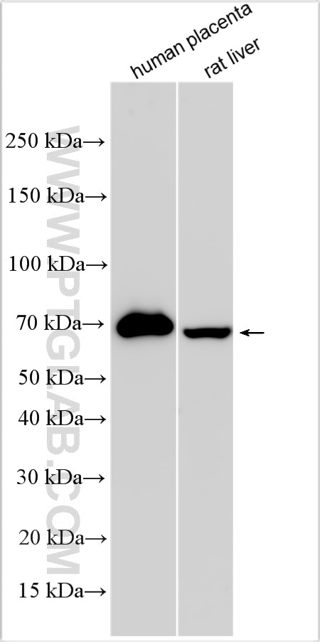 Western Blot (WB) analysis of various lysates using FAM161A Polyclonal antibody (32256-1-AP)