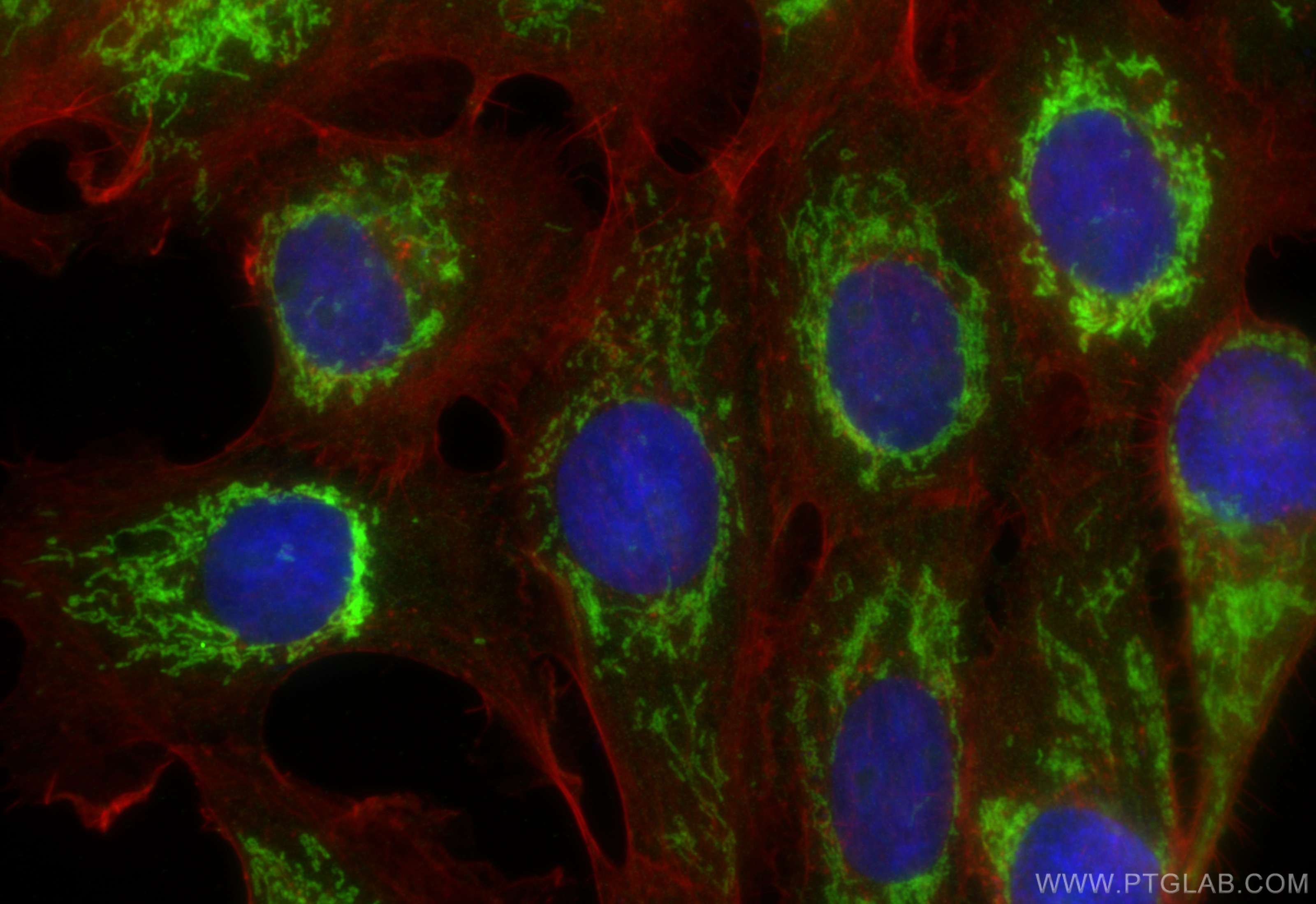 Immunofluorescence (IF) / fluorescent staining of A431 cells using FAM162A Polyclonal antibody (32034-1-AP)