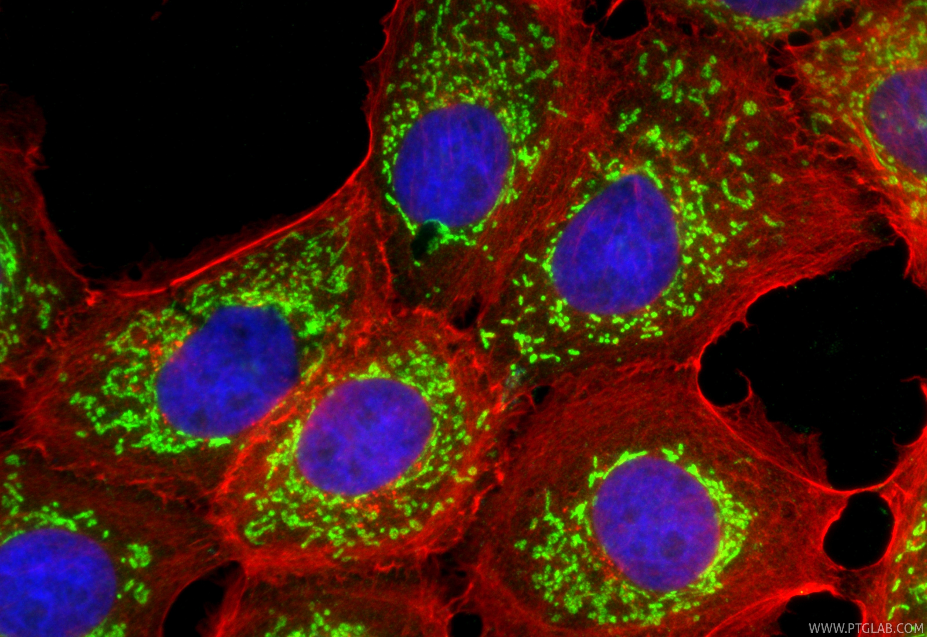 Immunofluorescence (IF) / fluorescent staining of A431 cells using FAM162A Polyclonal antibody (32034-1-AP)