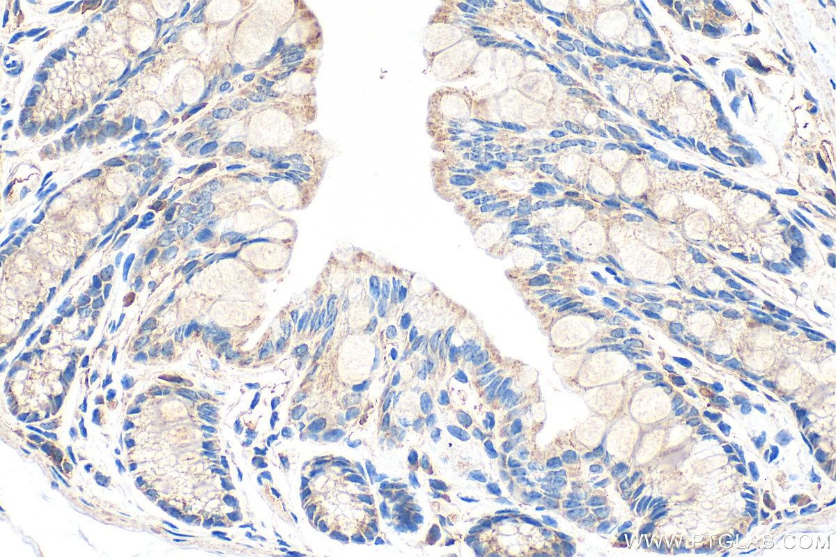 Immunohistochemistry (IHC) staining of mouse colon tissue using FAM162A Polyclonal antibody (32034-1-AP)