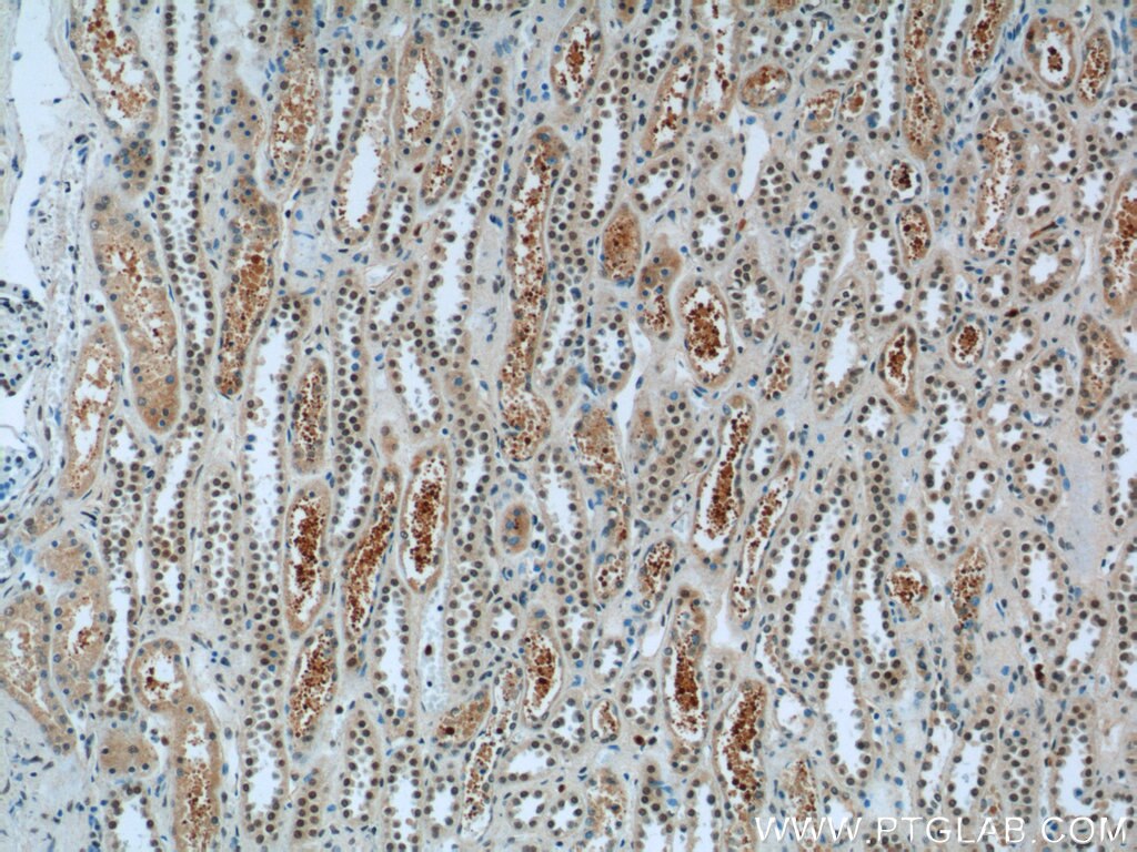 Immunohistochemistry (IHC) staining of human kidney tissue using FAM164C Polyclonal antibody (20520-1-AP)