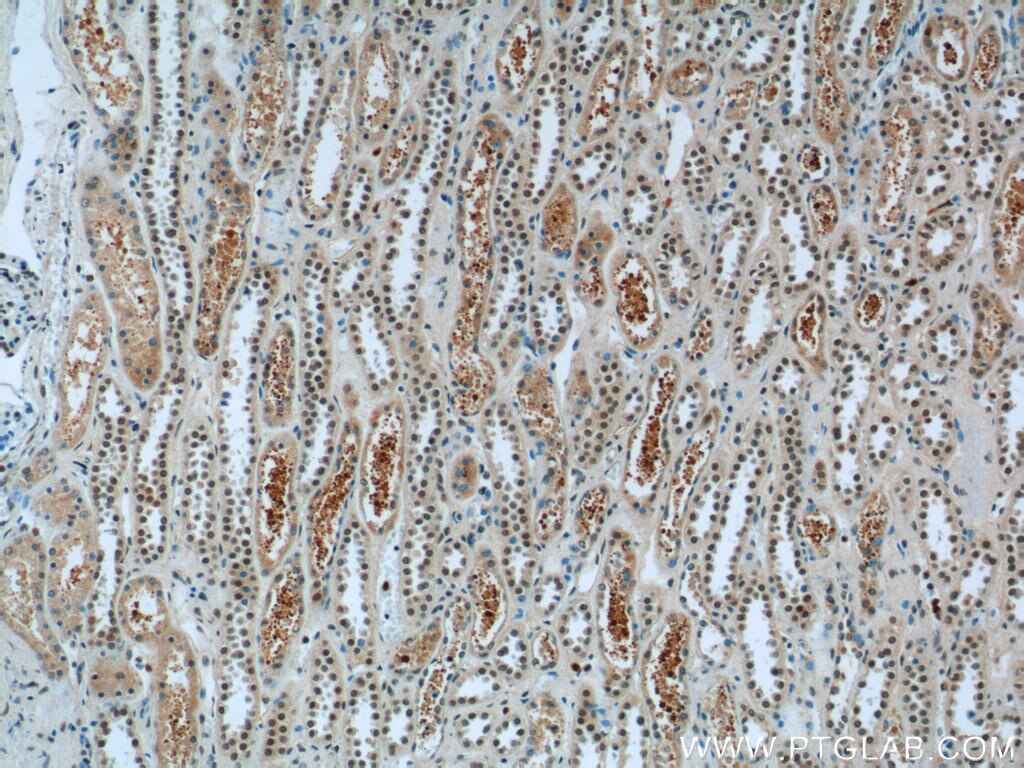 Immunohistochemistry (IHC) staining of human kidney tissue using FAM164C Polyclonal antibody (20520-1-AP)