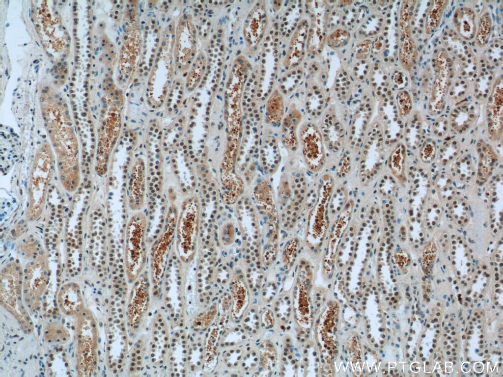 IHC staining of human kidney using 20520-1-AP