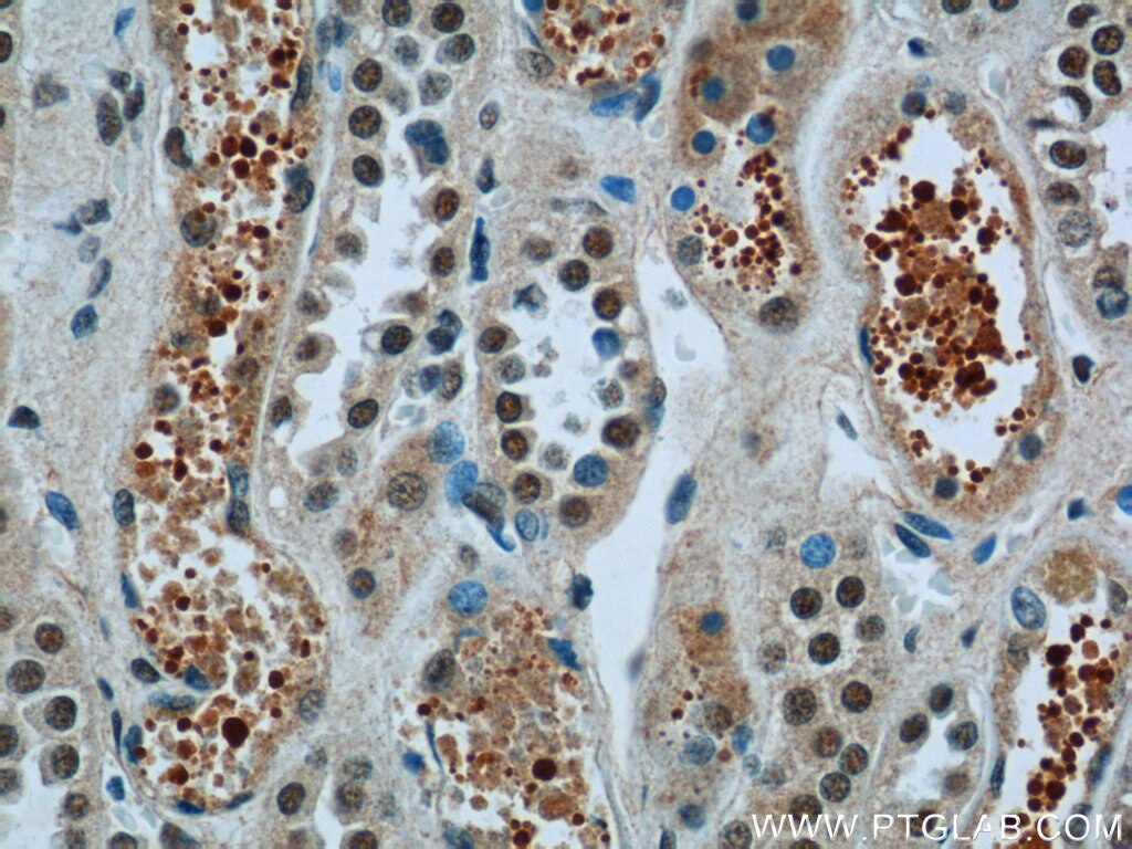 Immunohistochemistry (IHC) staining of human kidney tissue using FAM164C Polyclonal antibody (20520-1-AP)