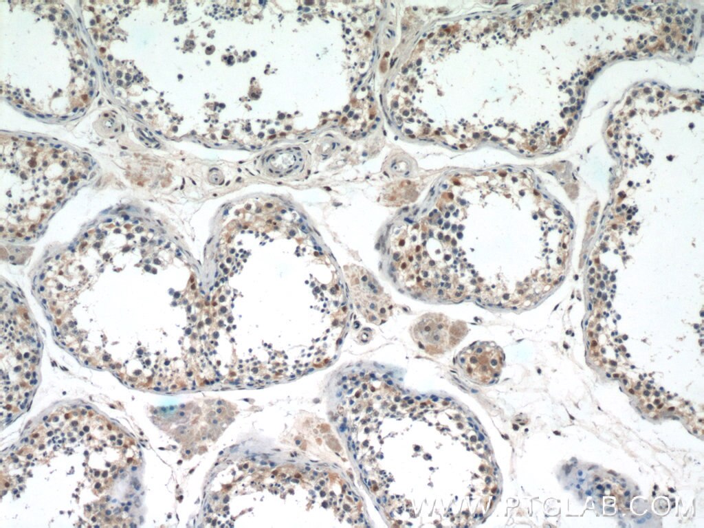 IHC staining of human testis using 20520-1-AP