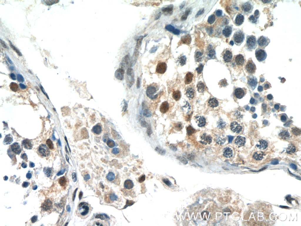 Immunohistochemistry (IHC) staining of human testis tissue using FAM164C Polyclonal antibody (20520-1-AP)