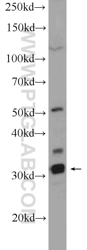 Western Blot (WB) analysis of HeLa cells using FAM164C Polyclonal antibody (20520-1-AP)