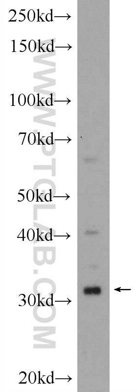 Western Blot (WB) analysis of C6 cells using FAM164C Polyclonal antibody (20520-1-AP)