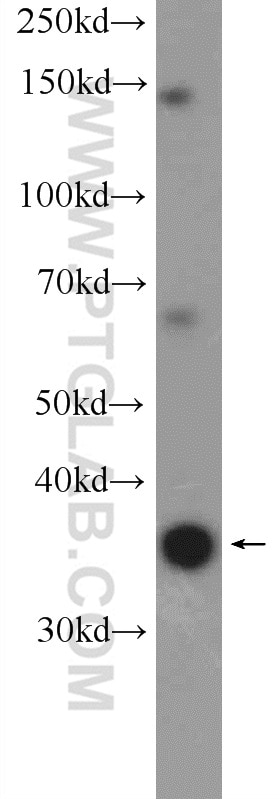 Western Blot (WB) analysis of HeLa cells using FAM164C Polyclonal antibody (20520-1-AP)