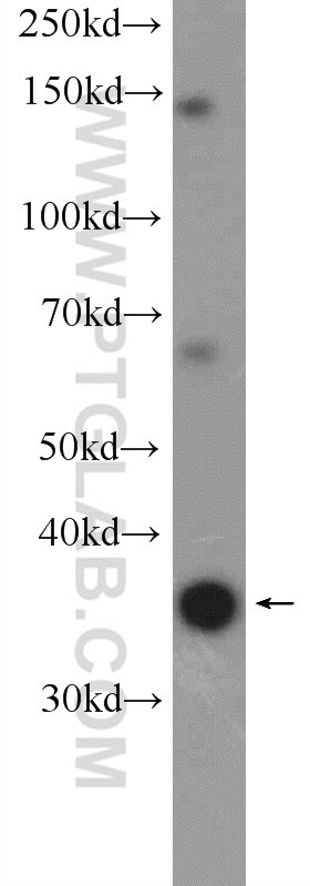 Western Blot (WB) analysis of HeLa cells using FAM164C Polyclonal antibody (20520-1-AP)