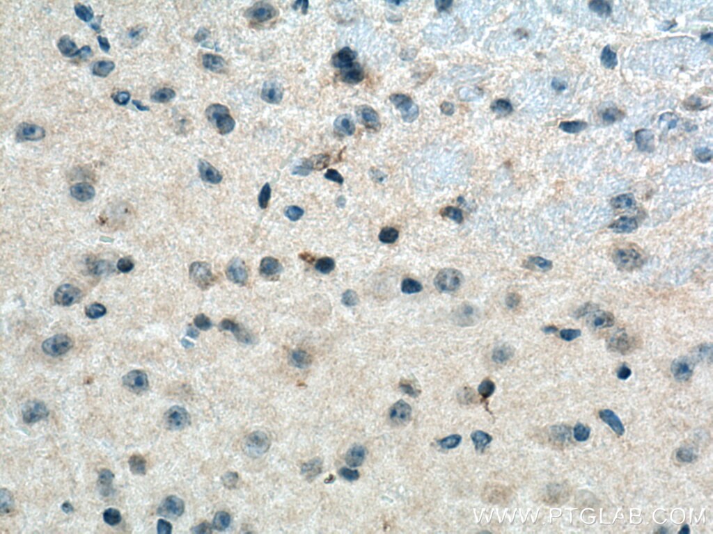 Immunohistochemistry (IHC) staining of mouse brain tissue using FAM171A2 Polyclonal antibody (20836-1-AP)