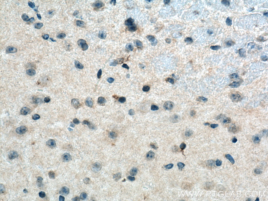 IHC staining of mouse brain using 20836-1-AP