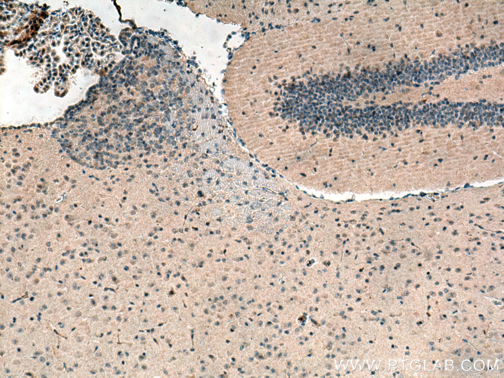 IHC staining of mouse brain using 20836-1-AP