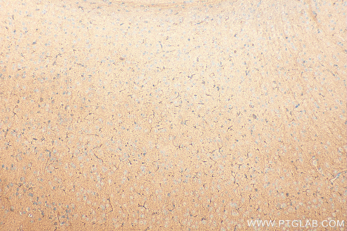 Immunohistochemistry (IHC) staining of mouse brain tissue using FAM171A2 Polyclonal antibody (20836-1-AP)