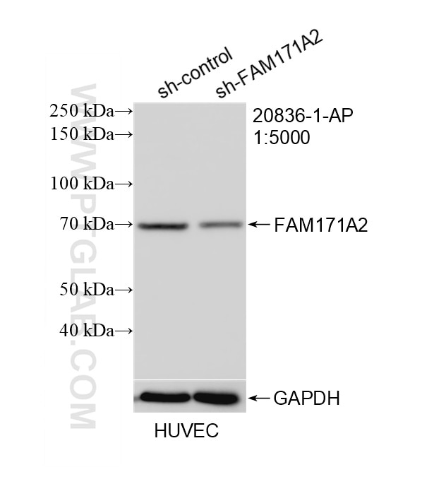 Western Blot (WB) analysis of HUVEC cells using FAM171A2 Polyclonal antibody (20836-1-AP)