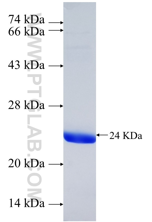 FAM171B fusion protein Ag37088 SDS-PAGE FAM171B fusion protein Ag37088 SDS-PAGE