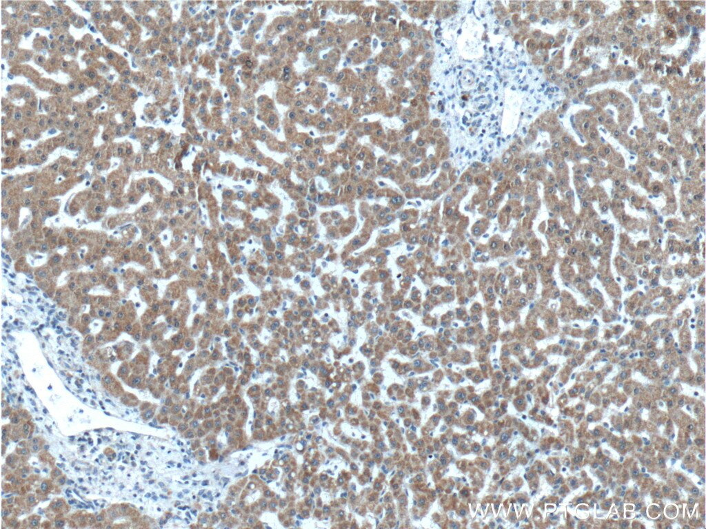 Immunohistochemistry (IHC) staining of human liver tissue using FAM172A Polyclonal antibody (24732-1-AP)